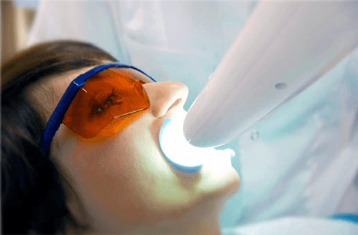 Understanding the Causes of Teeth Sensitivity Hartlepool