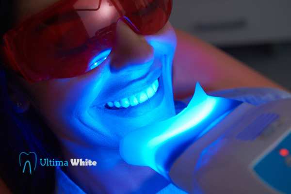 Professional Teeth Whitening Options Hartlepool