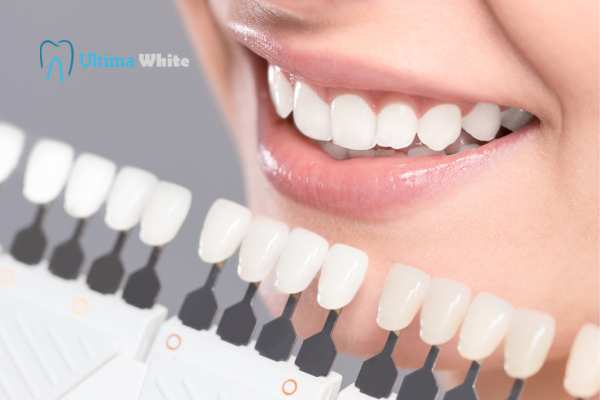 How to Maximise the Results of Your Laser Teeth Whitening Treatment Hartlepool