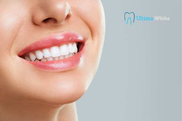 Common Mistakes That Can Ruin Your Whitening Results Hartlepool