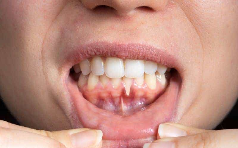 Final Thoughts: Building Lifelong Enamel Protection Habits Hartlepool