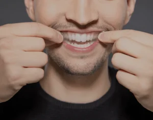 Overview of Home Teeth Whitening Kits Hartlepool