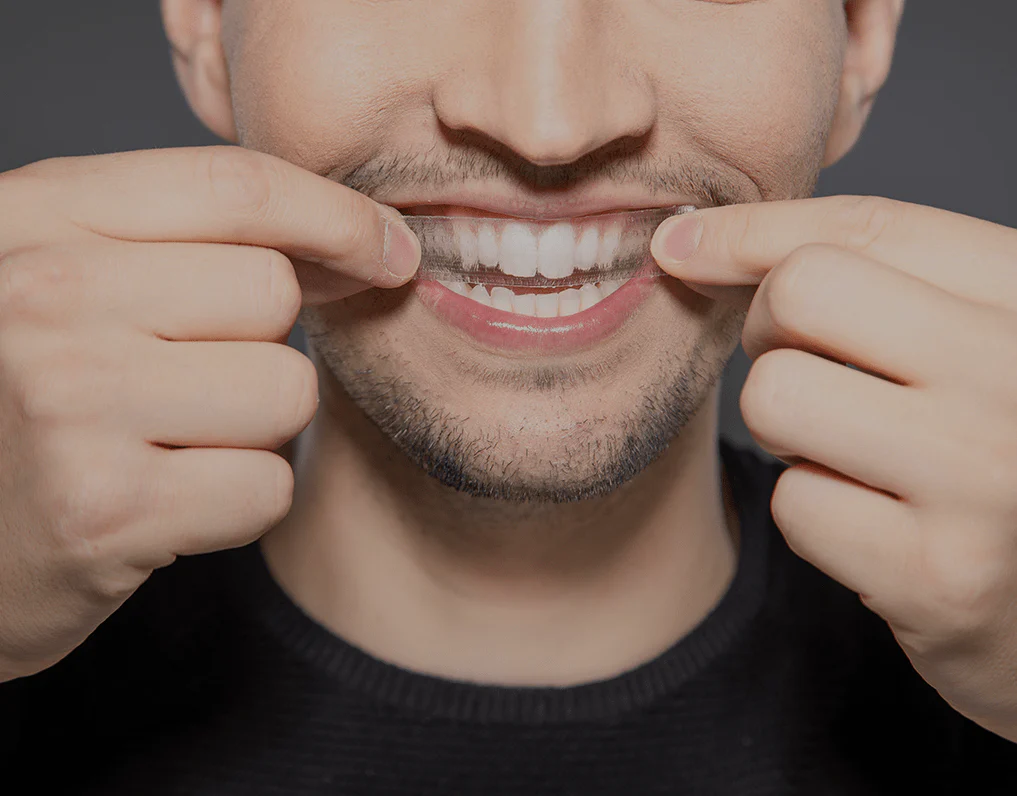 How Are Invisible Aligners Changing Orthodontic Treatments Hartlepool?