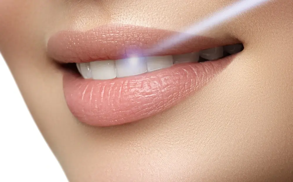 Understanding Teeth Whitening Risks and Results Hartlepool
