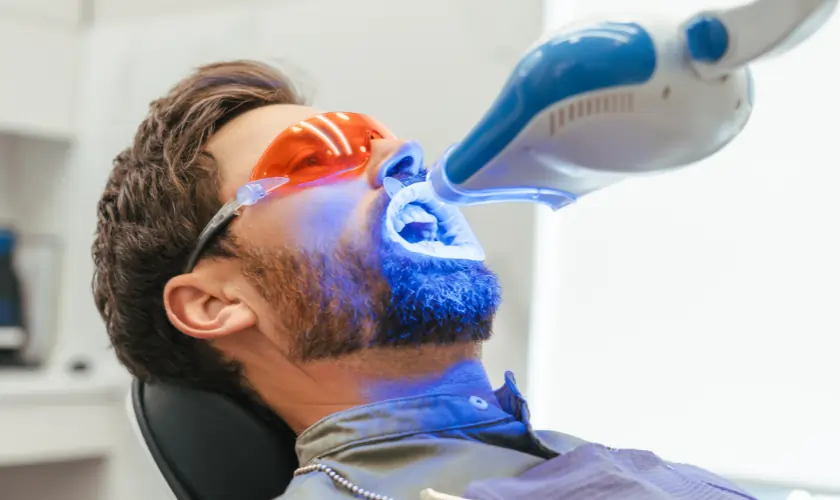 Does At-Home Whitening Actually Work?