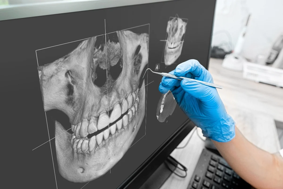How Is AI Transforming Dental Treatment Planning Hartlepool?