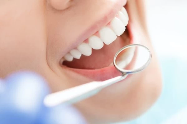 Preventing Complications: Tips for Maintaining Oral Health Hartlepool