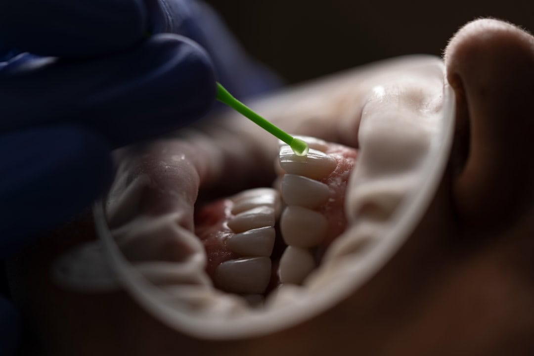 Common Causes of Persistent Dry Mouth Hartlepool