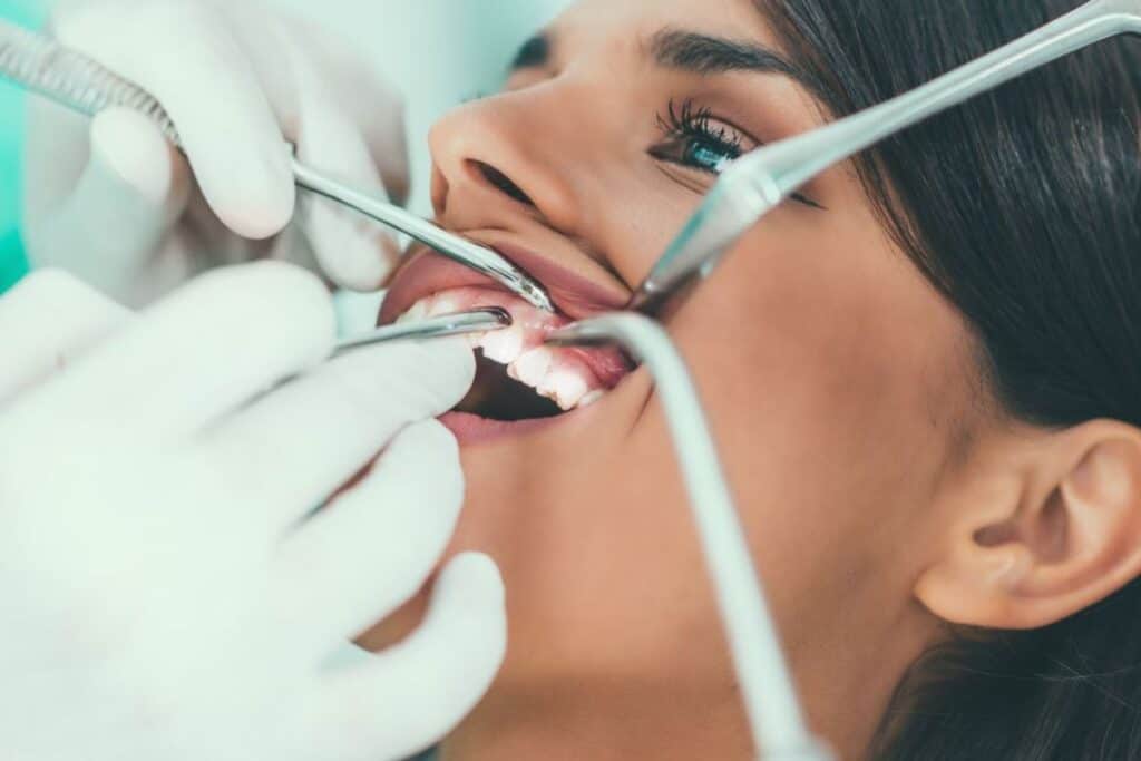 Braces Are Just for Kids – Myth or Reality Hartlepool