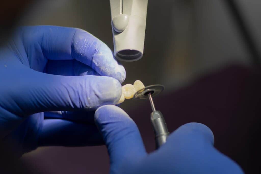 Customised Dental Solutions: Crowns, Aligners, and Implants Hartlepool