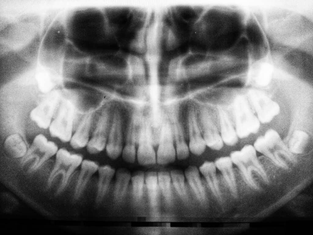 The Future of 3D Printing in Oral Healthcare Hartlepool