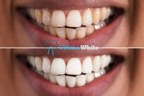 Long lasting results from Ultima White Hartlepool